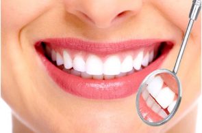 [Góc tư vấn] Bọc răng sứ là gì? Bọc răng sứ ở đâu tốt và uy tín?