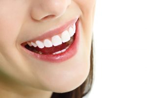 3M Lava Plus là loại răng sứ cao cấp nhất của Mỹ