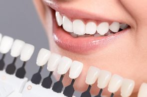 Có nên bọc răng sứ không? 10 lợi ích “khủng" khi bọc răng sứ