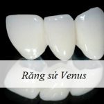 Răng sứ Venus: Tìm Hiểu Một Số Thông Tin Chi Tiết