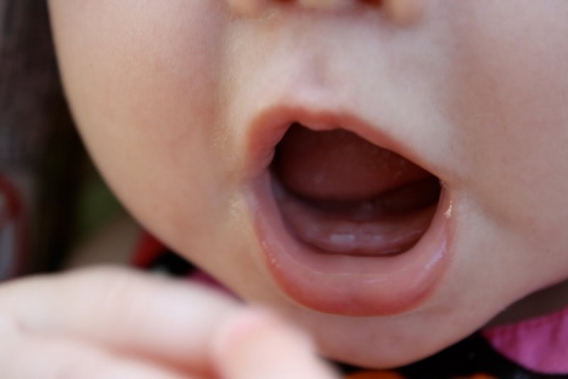 Cơ thể dư thừa phốt pho cũng có thể khiến trẻ chậm mọc răng