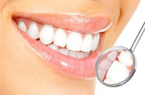 Trồng răng sứ: Bỏ túi những thông tin quan trọng cần nhớ kỹ