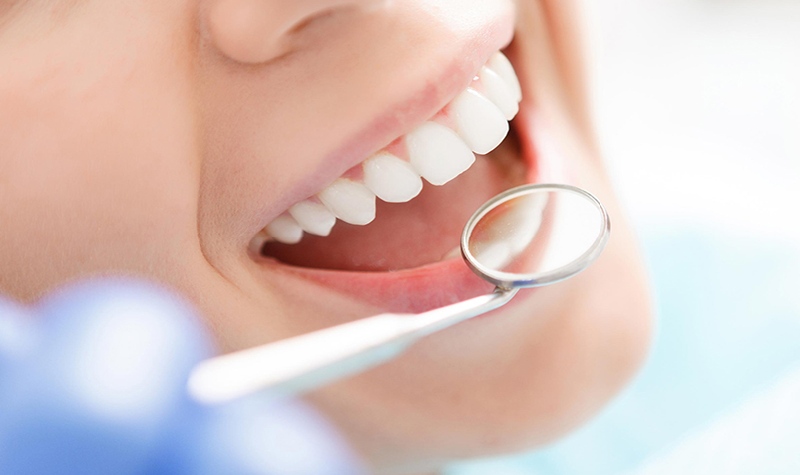Bọc răng sứ giúp giải quyết các khuyết điểm của hàm răng mọc lệch lạc