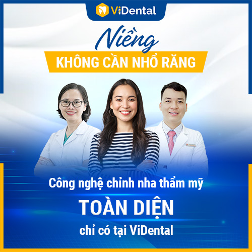 Niềng răng không nhổ răng tại ViDental