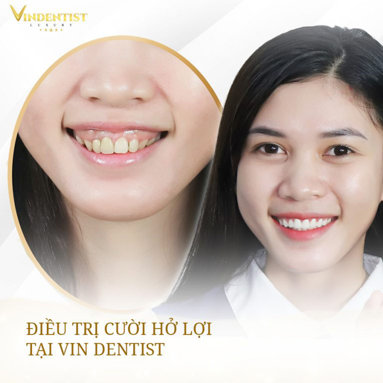 Nha khoa Vin Dentist