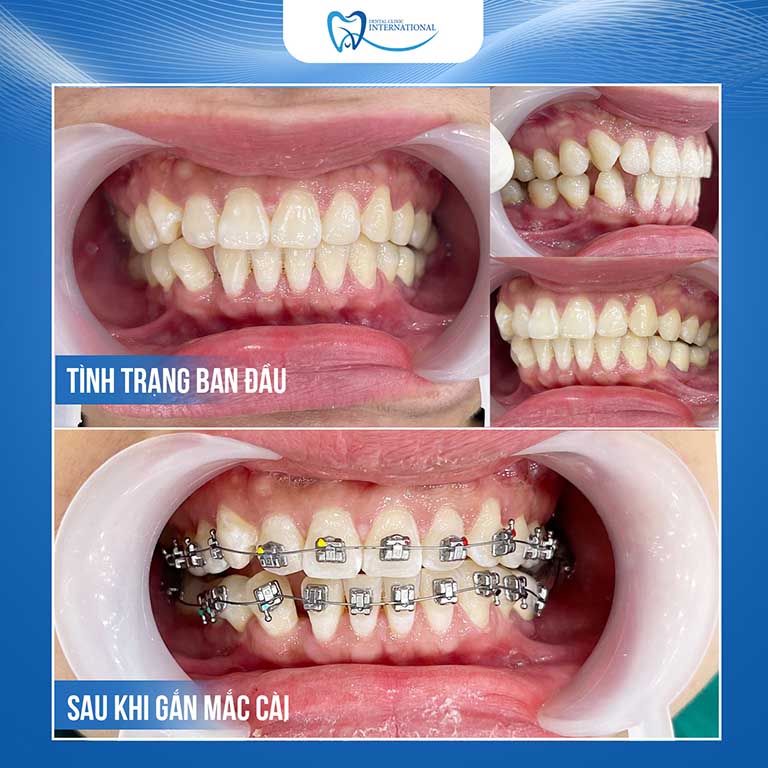 Nha khoa Quốc tế Dental Clinic International
