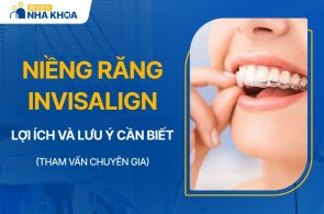 Dịch vụ niềng răng Invisalign