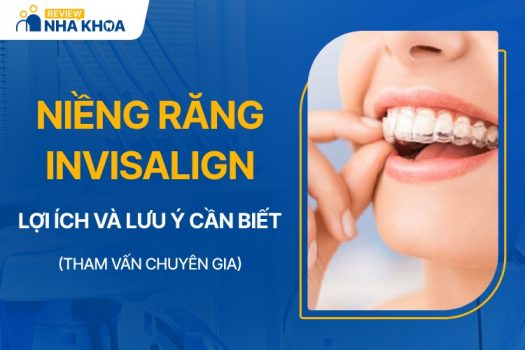 Dịch vụ niềng răng Invisalign