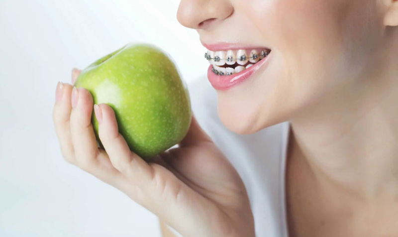 Việc ăn nhai, vệ sinh răng miệng dễ dàng hơn khi niềng răng