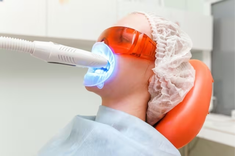 Sử dụng tia laser kích thích chất tẩy trắng răng