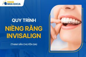 Quy trình niềng răng Invisalign