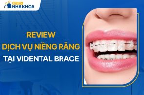 Review dịch vụ niềng răng tại trung tâm ViDental Bracec