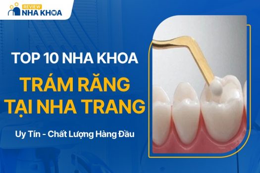 Địa chỉ nha khoa trám răng tại Nha Trang