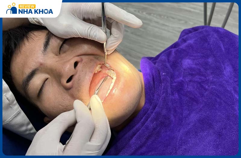 Tâm Đức là địa chỉ nha khoa Thuận An có hơn 20 năm kinh nghiệm trong lĩnh vực răng hàm mặt